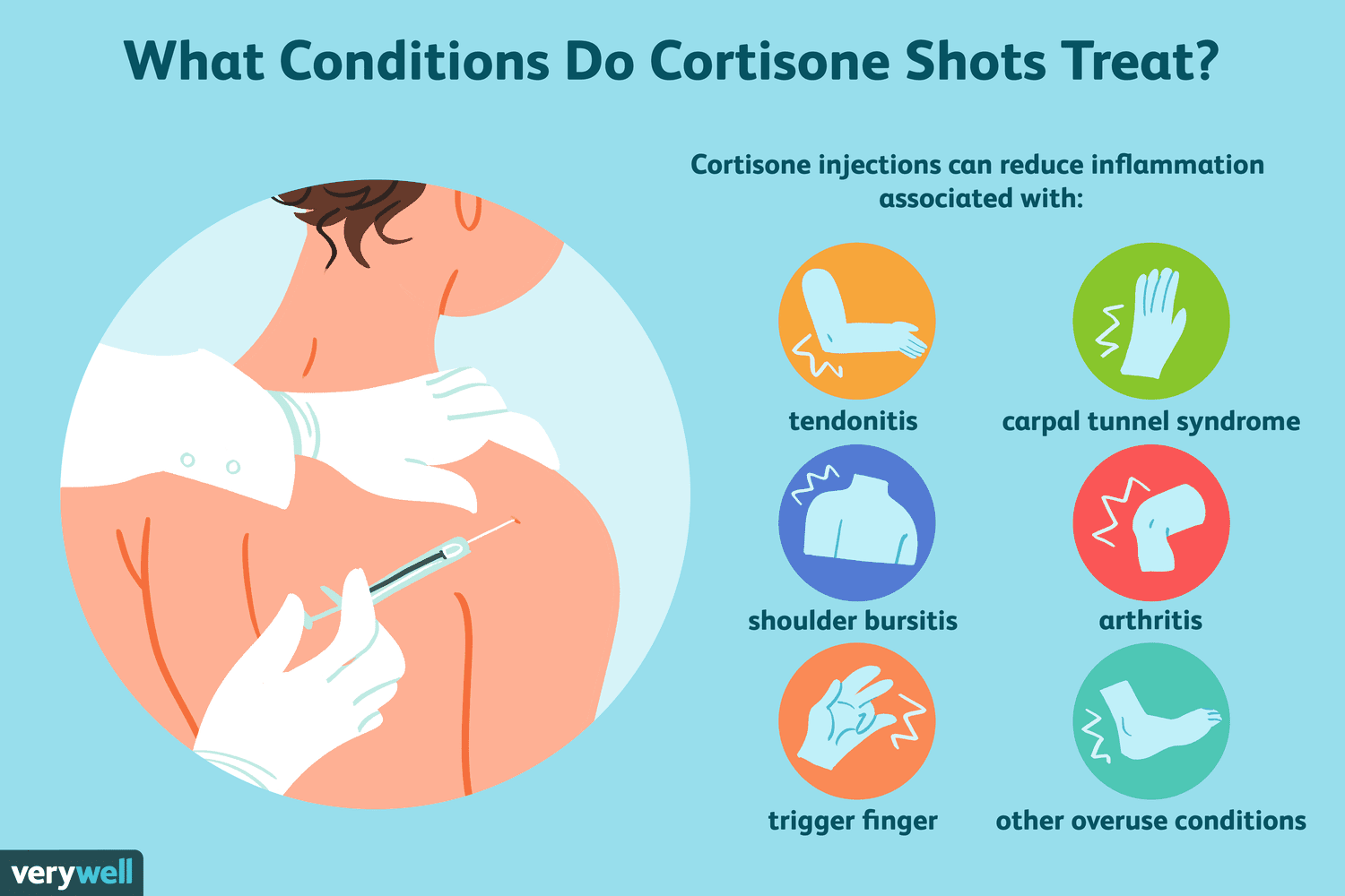 How Long Do Cortisone Shots Take to Kick In?