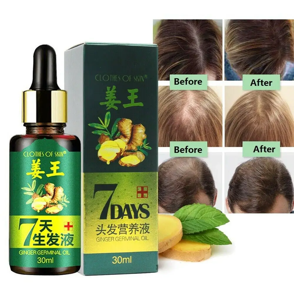 How to Use Hair Growth Serum