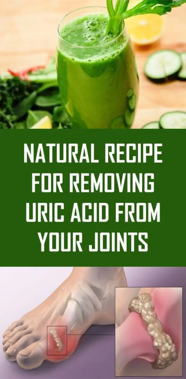 Ingredients in Uric Acid Medicine