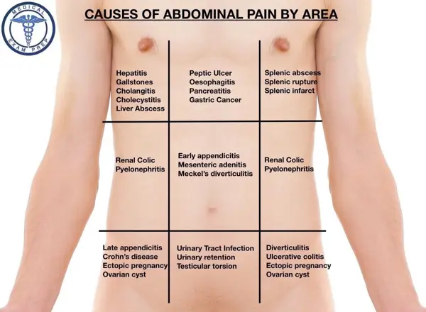 Treatment Options for Abdominal Pain Under Ribs Middle