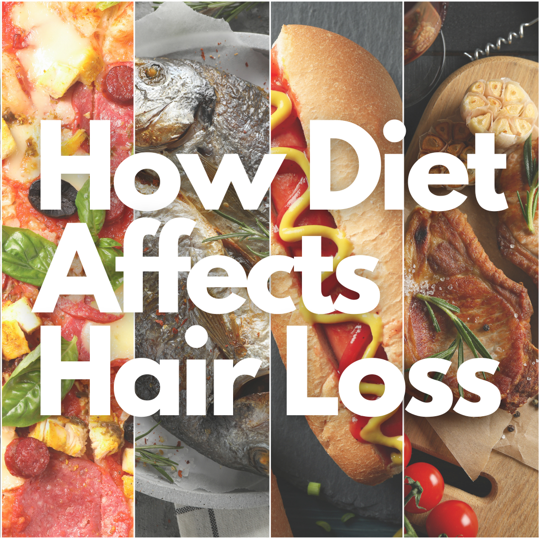 does diet affect hair loss