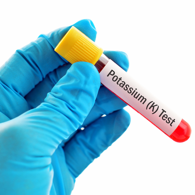 high potassium levels in blood test