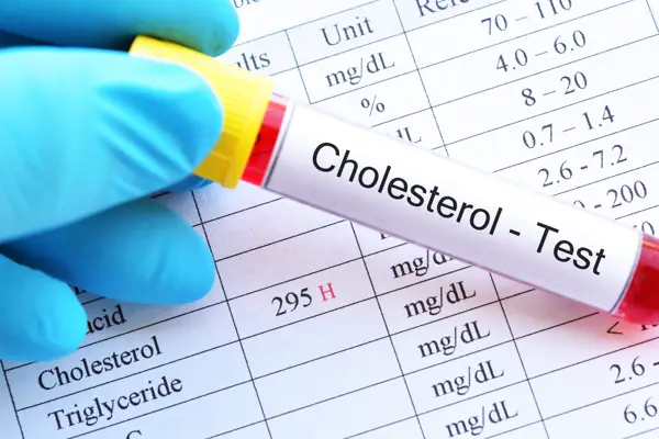 cholesterol test for high blood pressure