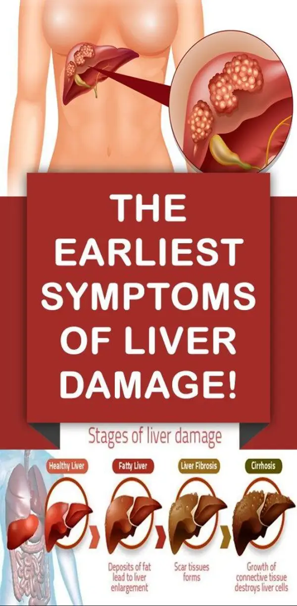 what liver problems cause high cholesterol