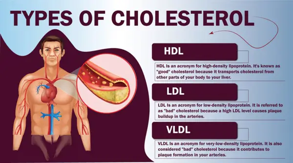 Symptoms of Chest Pain Due to High Cholesterol