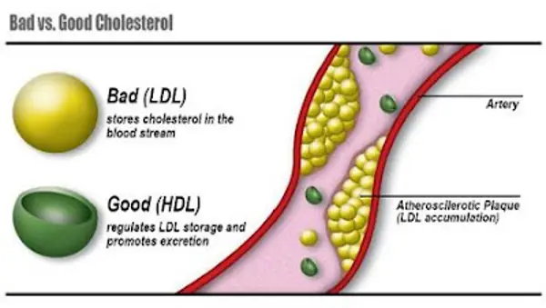 is 120 ldl cholesterol bad