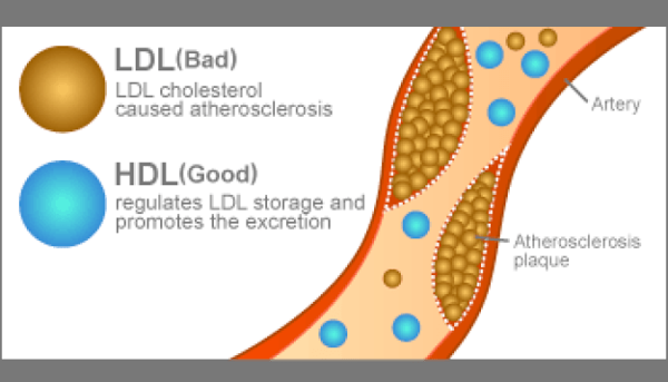 is non hdl cholesterol ldl