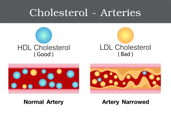 is cholesterol level of 2.7 good