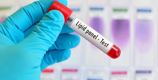 Does a Lipid Panel Test for Diabetes?