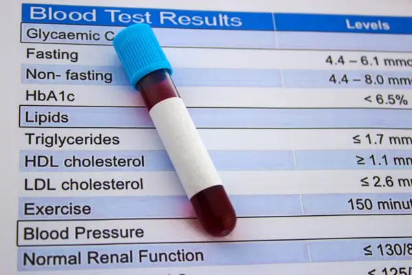 Interpreting Lipid Panel Test Results