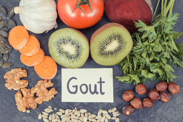 Overview of Gout