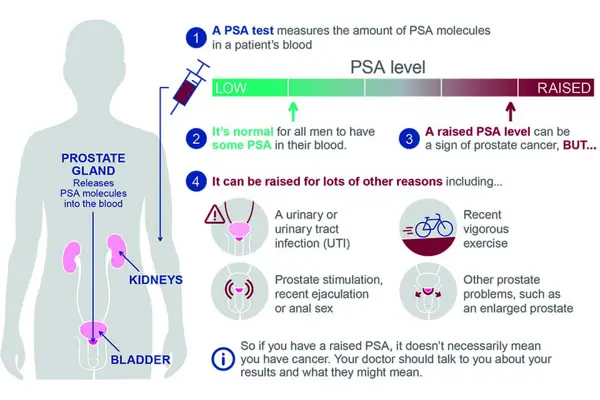 Role of Free PSA in Diagnosis