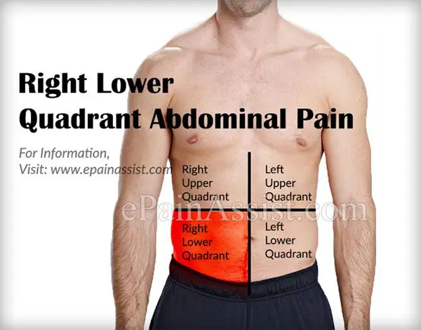 lower right abdomen pain after drinking alcohol