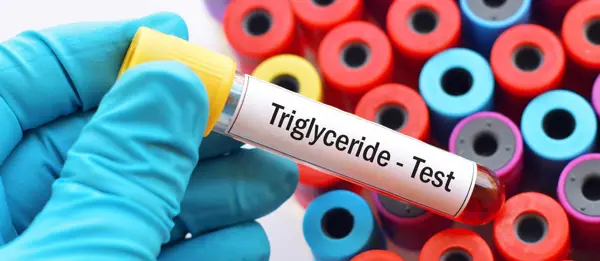 Managing High Triglycerides