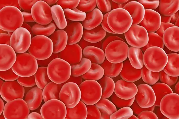 Causes of High White Blood Cell Count
