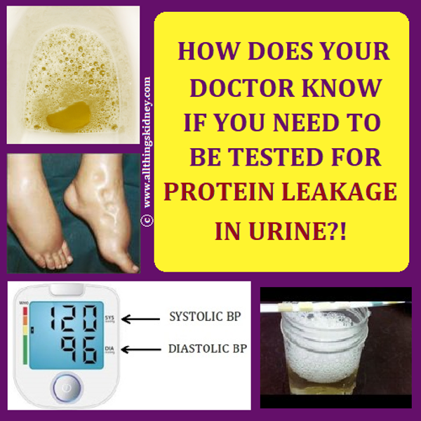 Diagnosing High Protein in Urine and High White Blood Cell Count