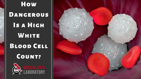 Implications of High White Blood Cell Count