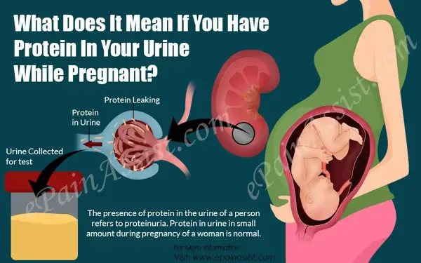 2. Causes of Protein in Urine During Pregnancy