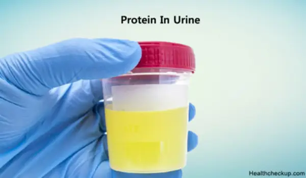 Complications of Low Protein in Urine