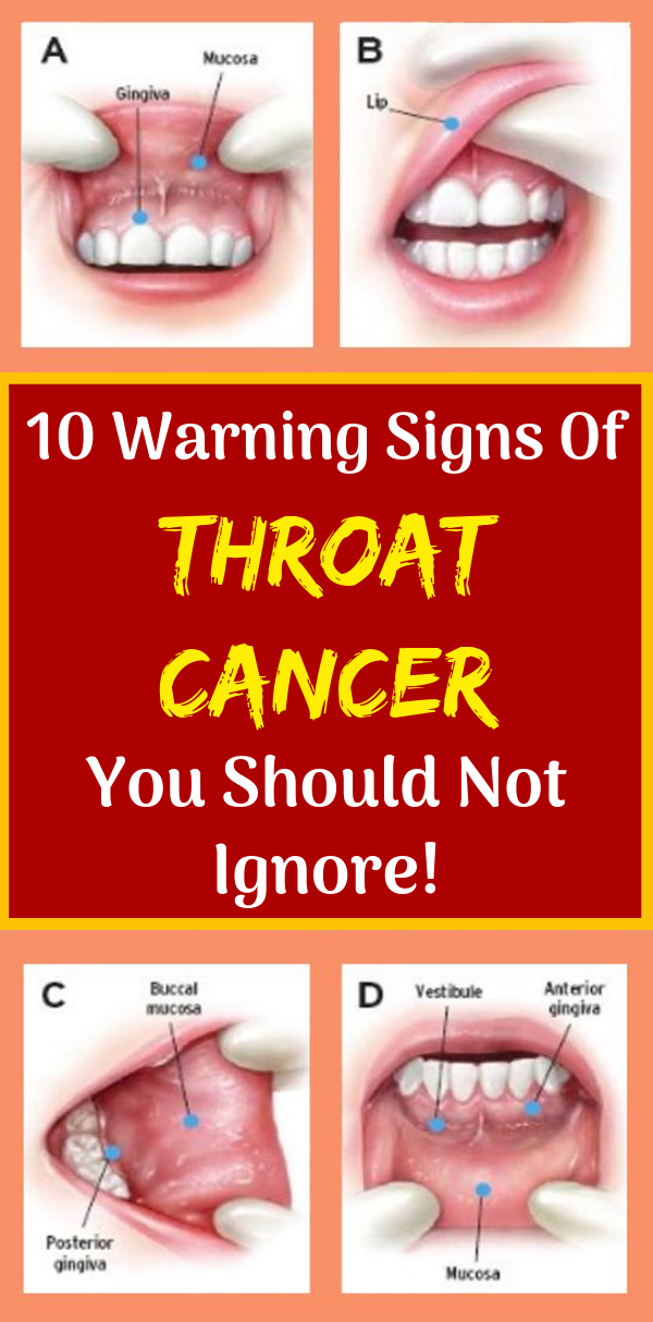 what should throat cancer patients eat