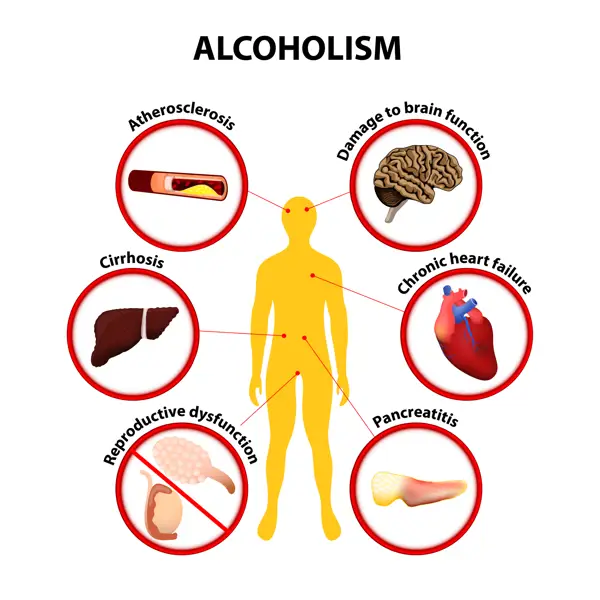 Health Impacts of Heavy Drinking on Different Weight Groups