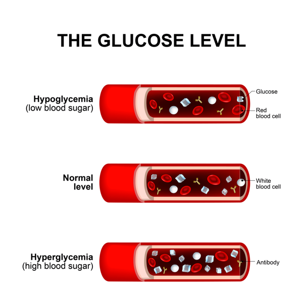 does blood sugar levels affect weight loss